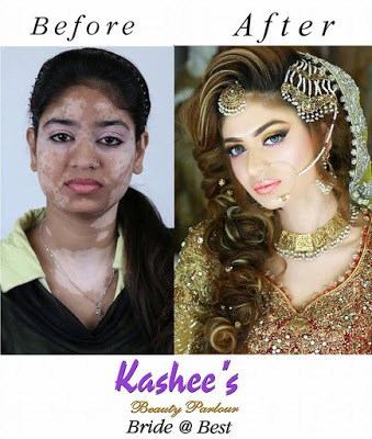 Kashees beauty parlour perfect skin transformation of girl