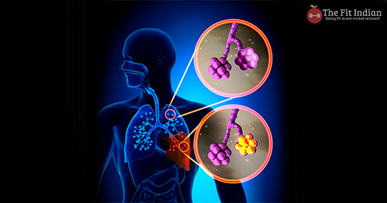 pneumonia reason for chest congestion